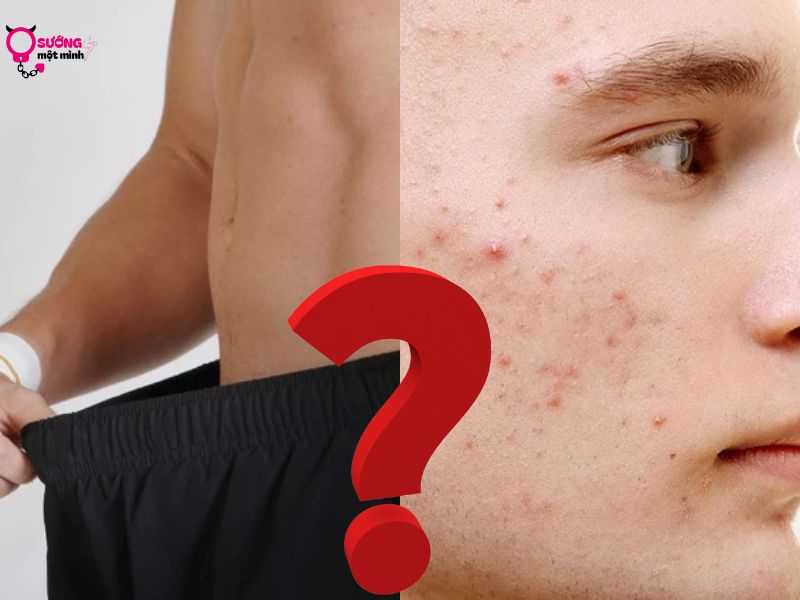 Thủ dâm có nổi mụn không?